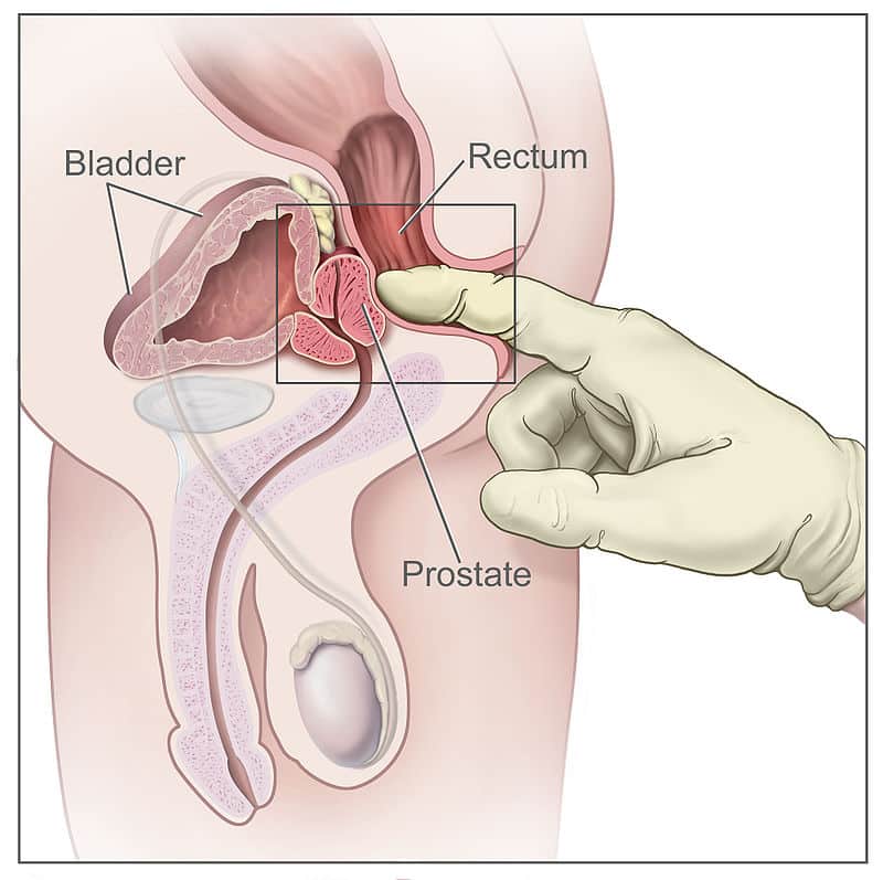 Prostate gland diagram showing location below bladder